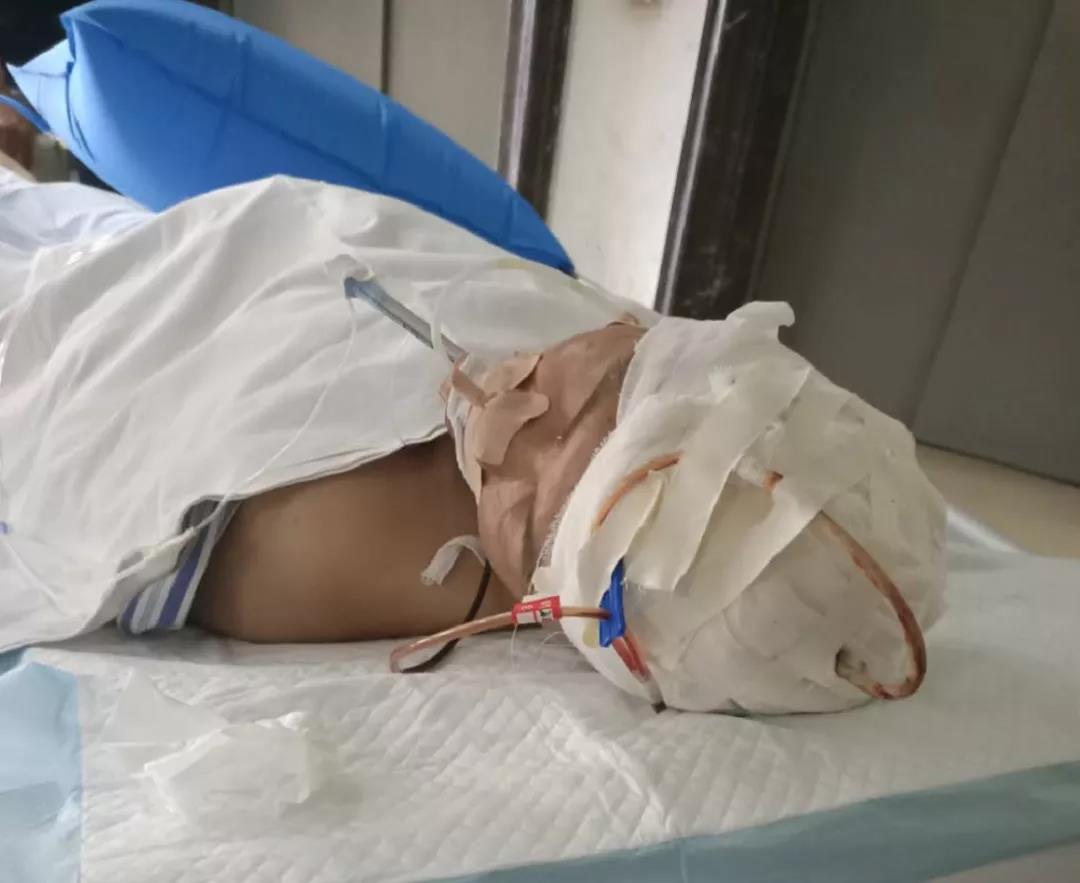 梁平45岁退伍兵司机突发脑梗,全车28名回乡乘客幸运无
