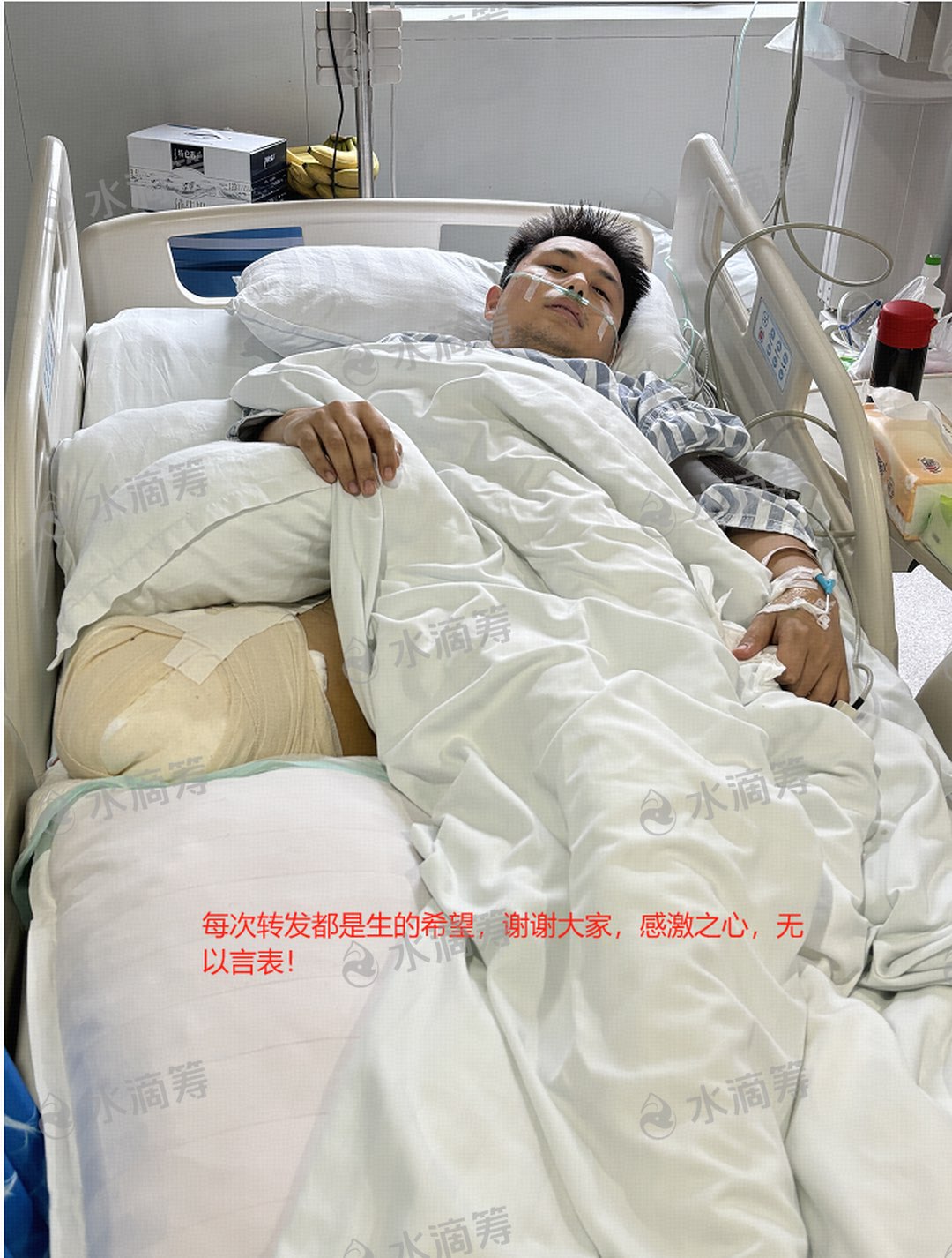 梁平26岁小伙张杨车祸导致右腿截肢，急需医40万元手术费……