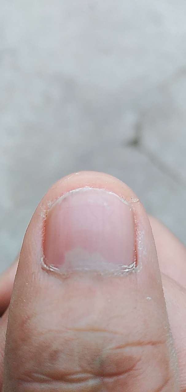 指甲月牙(白色)不规则,是因为试模时,忽然压下时,手还抽得快,当时指甲