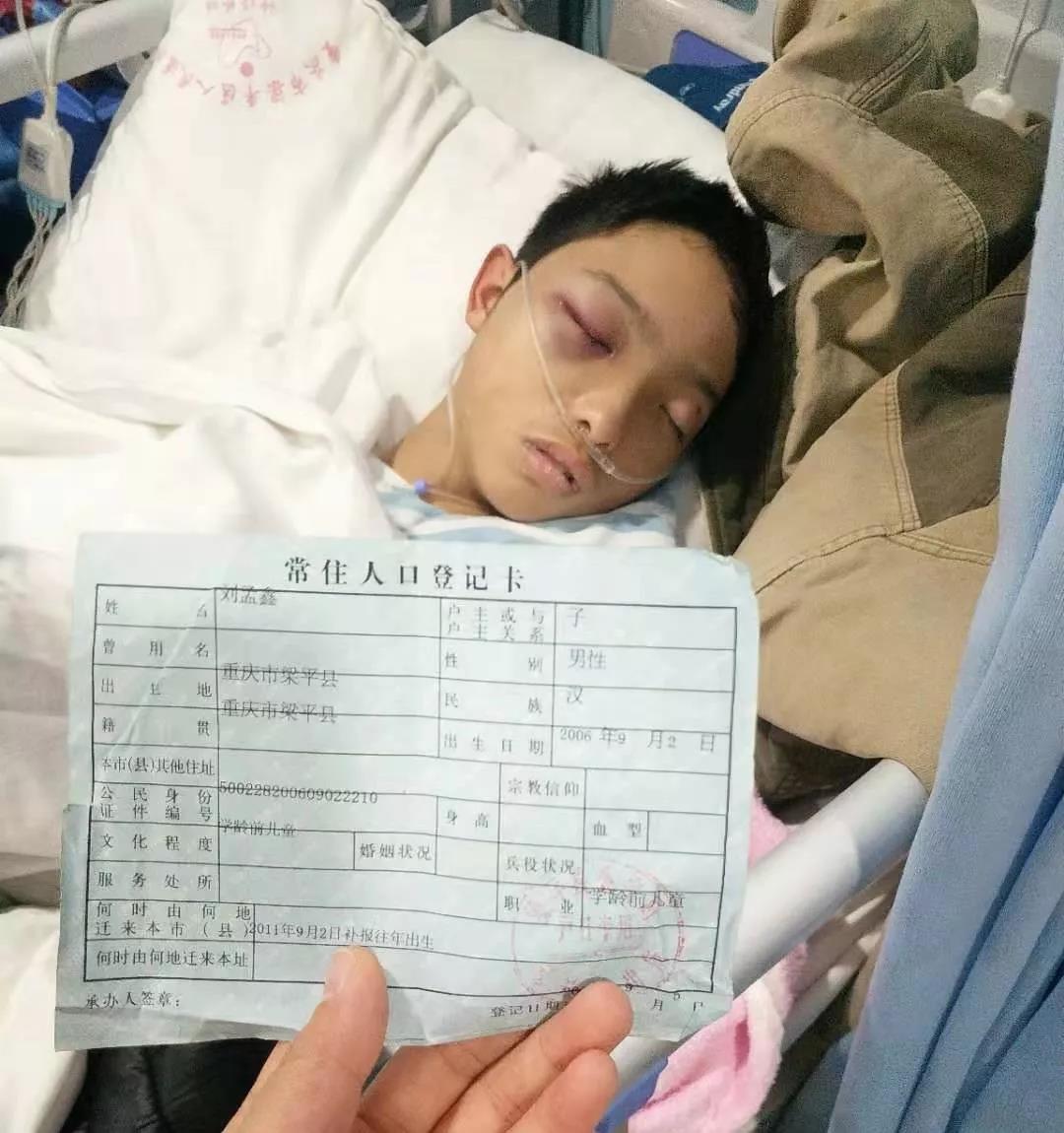 明达13岁男生家中二楼无栏杆摔下